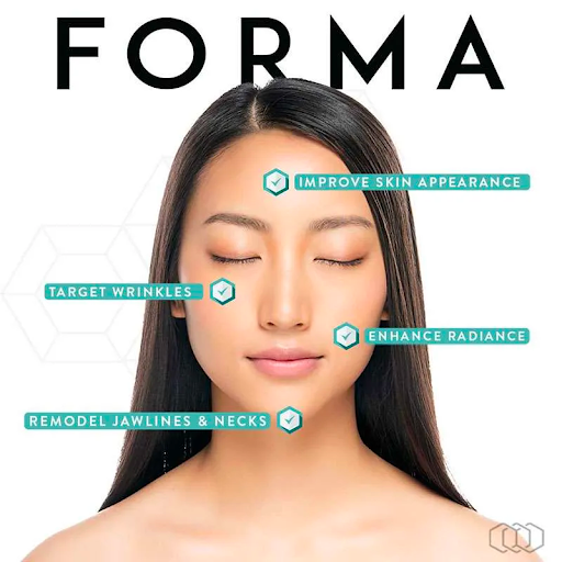 Forma RF Skin Tightening: The Gentle “Red Carpet” Treatment